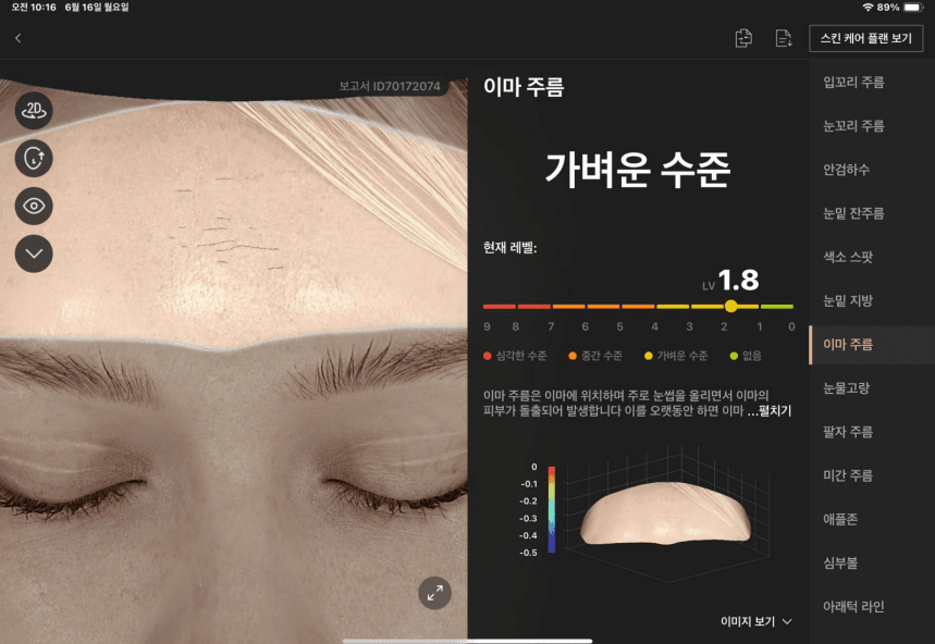 이마 주름 분석