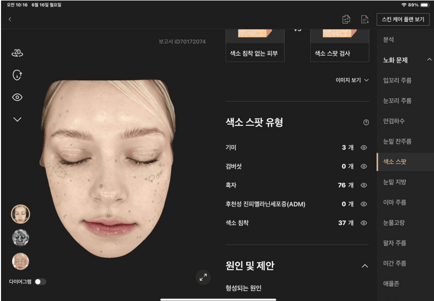 색소 분석