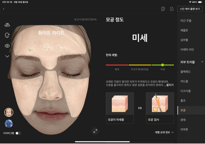 모공 분석
