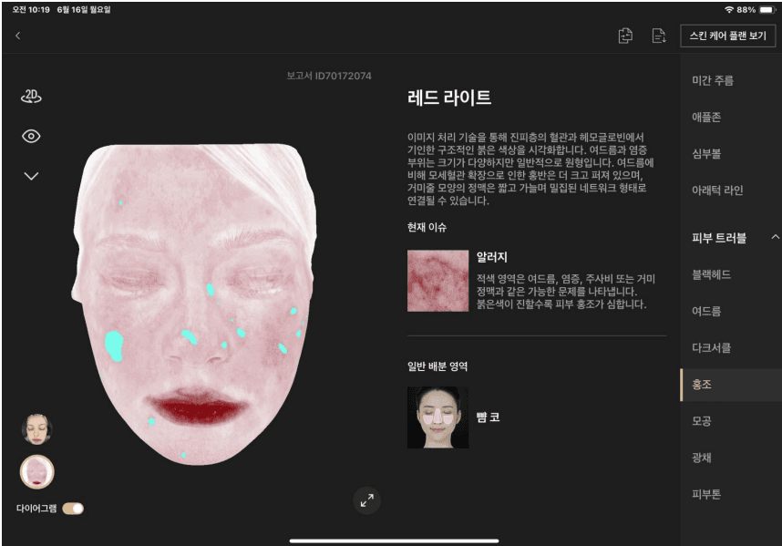 홍조 분석