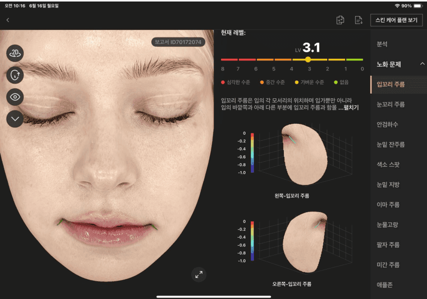 입꼬리 주름 분석