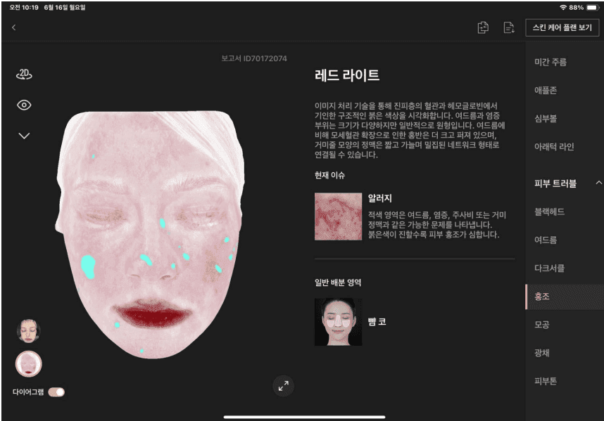 홍조 분석