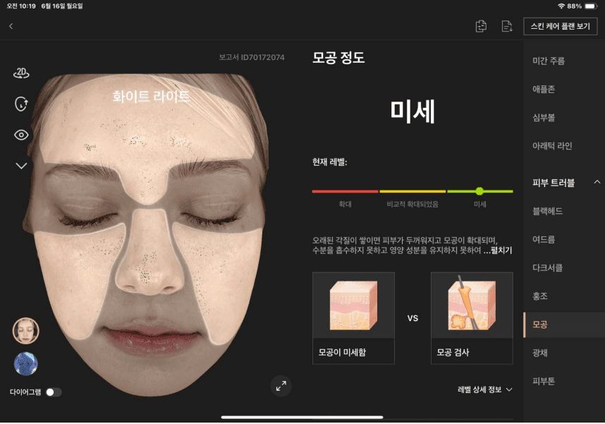모공 분석