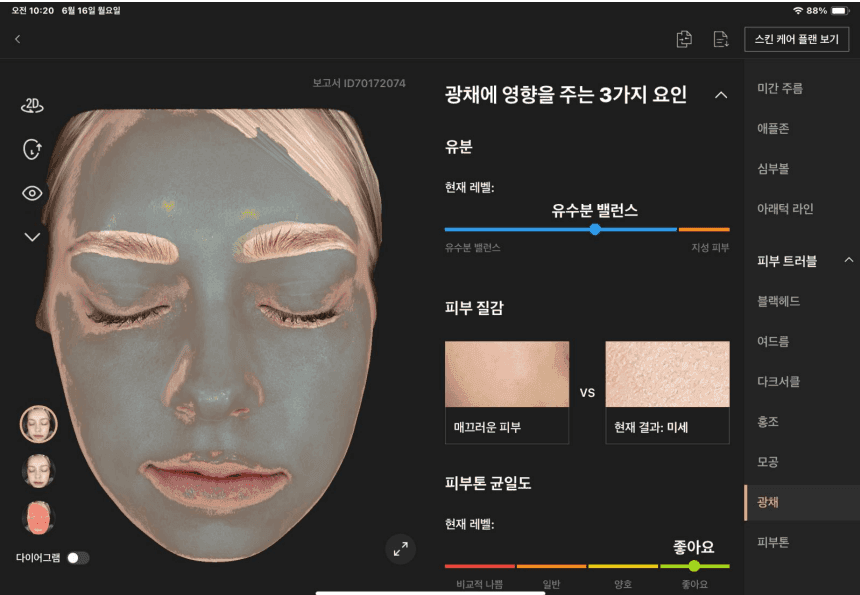광채 분석