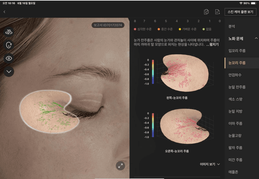 눈꼬리 주름 분석