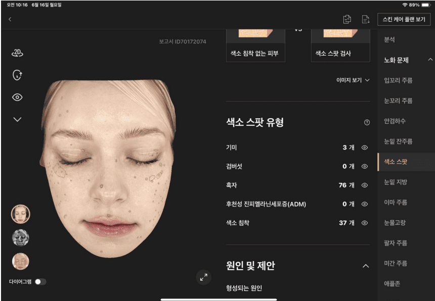 색소 분석