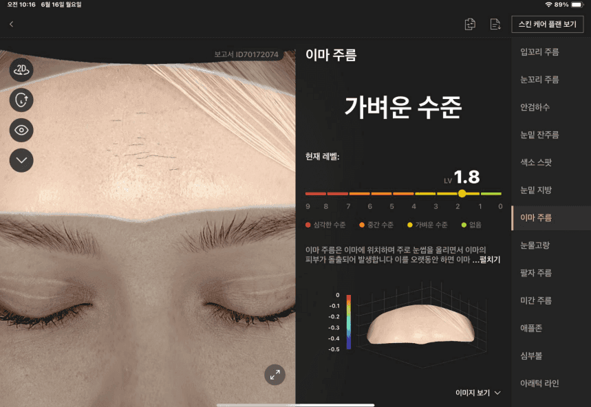 이마 주름 분석