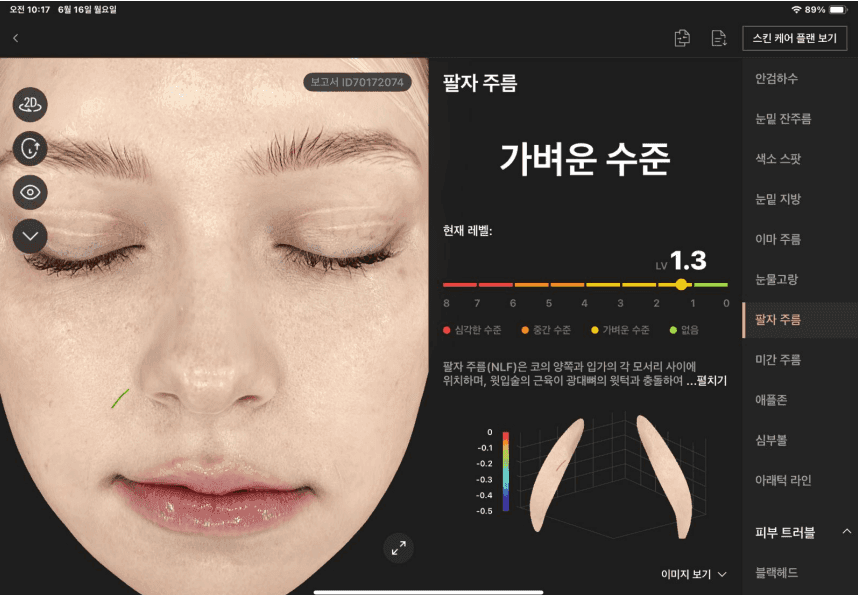 팔자 주름 분석